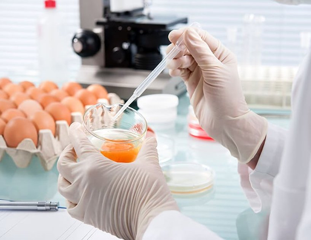Hygiena Alimentos